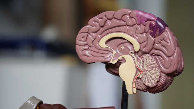 How to study for neuro - 3 tips to ace your exam